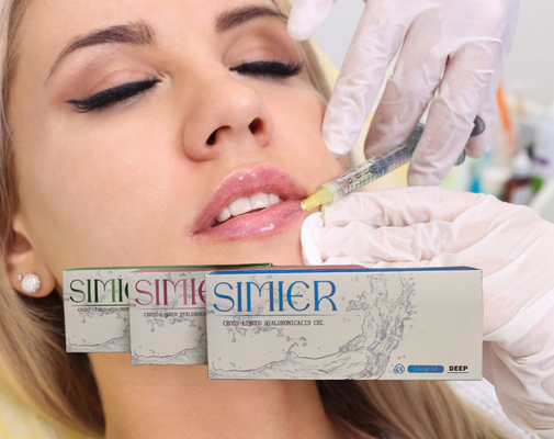 Cross Linked 5ml 30mg/ml Chin Hyaluronic Acid Injection Kháng nhăn