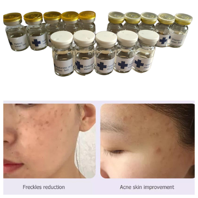 Hyamely Non Cross Linked Hyaluronic Acid Mesotherapy Solution 5Ml