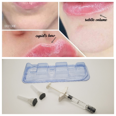 2ml Cross Linked Dermal Filler Nồng độ Ha cao 24mg/Ml Kháng nhăn