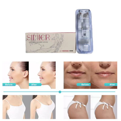 2ml Cross Linked Dermal Filler Nồng độ Ha cao 24mg/Ml Kháng nhăn