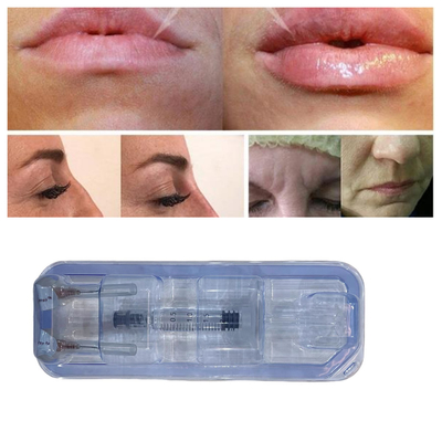 Tiêm thuốc lấp môi axit hyaluronic 24mg/ml chăm sóc khuôn mặt