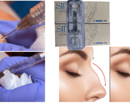 Hyaluronic Acid Face Injection Lip Dermal Filler Ce MSDS ISO