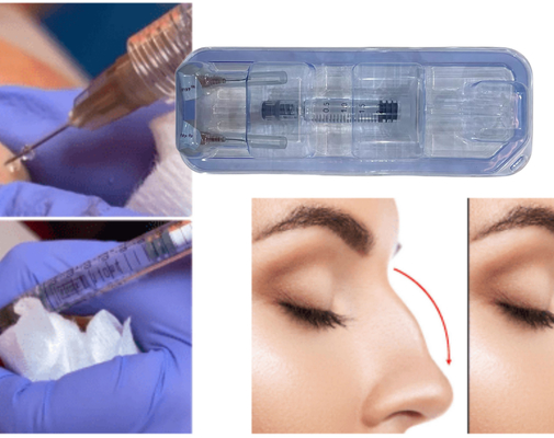 FDA chấp thuận tiêm gel axit hyaluronic cho mông