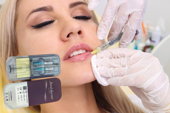 Các chất điền Hyaluronic Acid Gel 5ml Lip Dermal Filler Injections Injectable Dermal Filler