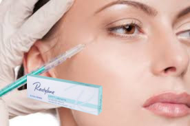 1.1ml Face Dermal Filler Anti Wrinkle Lip Filler Cho khuôn mặt