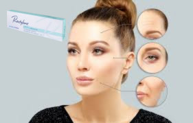 Hyaluronic Acid Dermal Filler 1x1.1ml Lip Filler