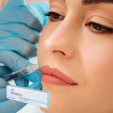 Hyaluronic Acid Injectable Dermal Filler Injectable Gel Cho môi