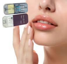 2 X 1ml Juvederm Ultra 4 Tiêm chất lấp da Tiêm chất lấp môi