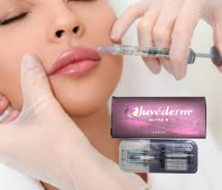 2 X 1ml Juvederm Ultra 4 Tiêm chất lấp da Tiêm chất lấp môi