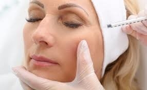 Các nếp nhăn mịn Dung đầy da tiêm axit hyaluronic Juvederm Ultra 3 2*1ml