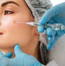 Các nếp nhăn mịn Dung đầy da tiêm axit hyaluronic Juvederm Ultra 3 2*1ml